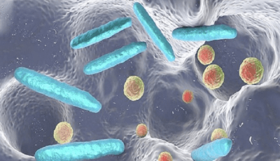 البكتيريا المعوية تزيد خطرَ الإصابة بسرطان القولون