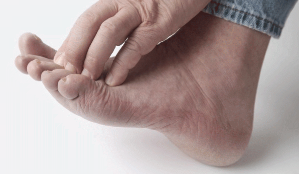 فطريات القدم - فطريات القدم السكري .. أسبابها و طرق الوقاية منها